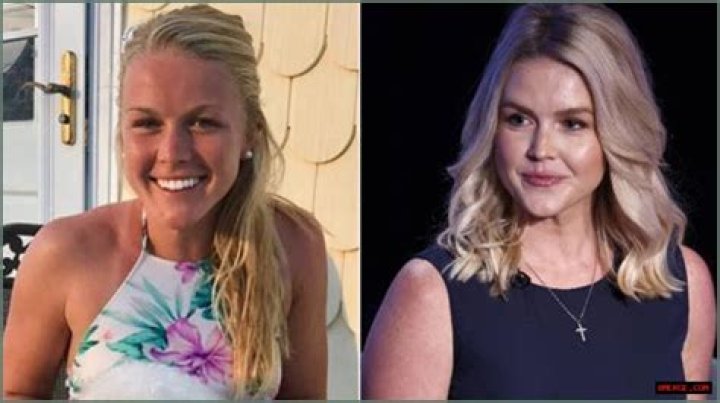 
Is Coco Lodge Love Island Trans? Nose Job and Surgery Rumors After Old Photos Resurface 