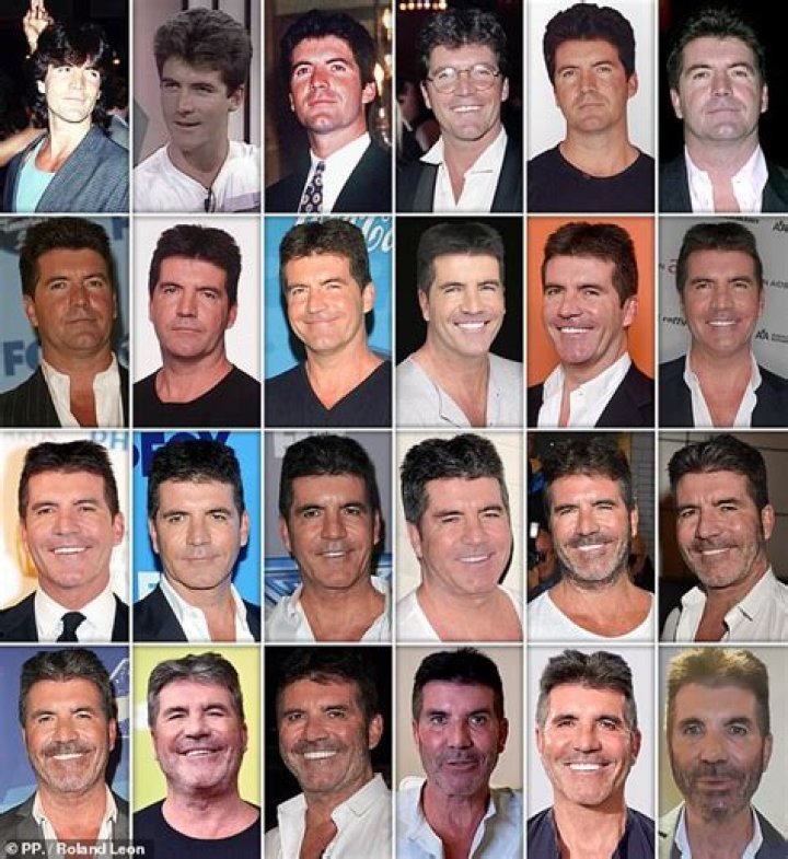 What Happened To Simon Cowell’s Face? Fans Concerned With His Disappearing Eyes